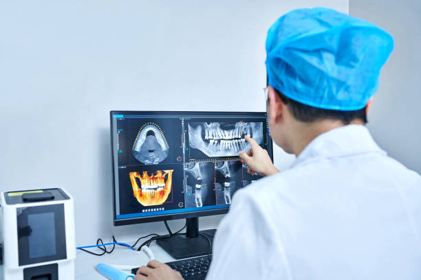 Best Emergency Broken Tooth Repair in USA